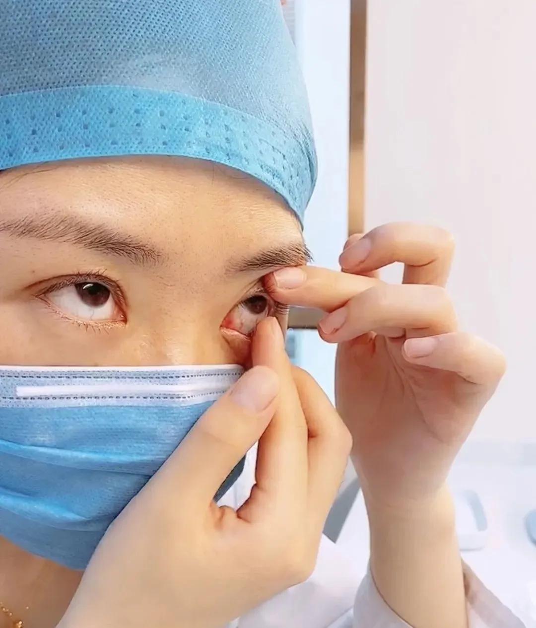 隐形眼镜怎么摘才不会伤害视网膜,隐形眼镜怎么摘都摘不下来怎么办