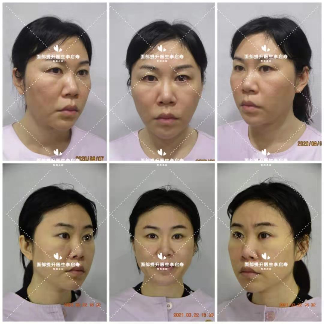 长脸型怎么美颜好看,长脸型怎么让脸胖点