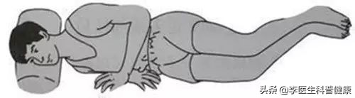 颈椎病睡哪种枕头对颈椎有好处,颈椎病怎么睡才是好得快