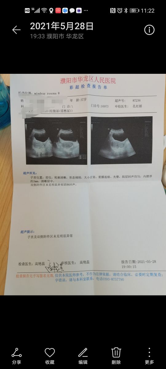 盆李小寨小媛怀孕四个月羊水流完，真的是公布早了吗？