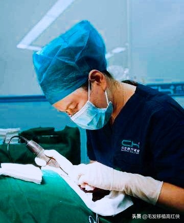 植发到底疼不疼,植发疼不疼