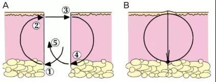 脸上太多痣了怎么能让它自动消失,脸上痣太多怎么在家去除