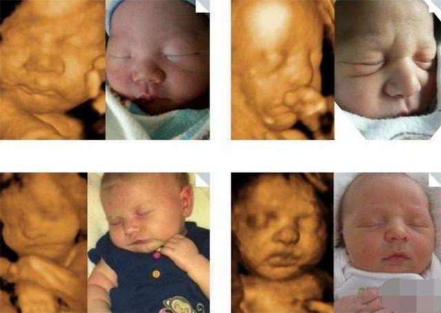 宝宝四维照片和生下来照片对比,四维照片所有宝宝都长得一样吗