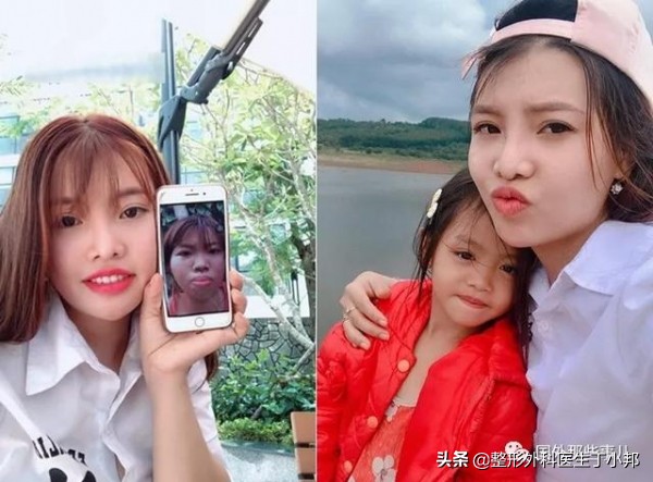 整容成功逆袭的女人,整容整形成功逆袭案例