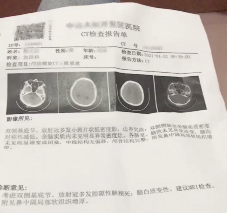 家人中风偏瘫恢复前后,父亲中风住院治疗方法