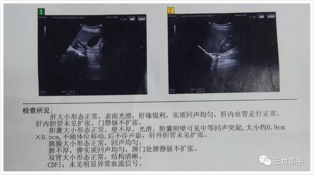 27岁女性胆囊息肉能自愈吗,7mm胆囊息肉会消失吗