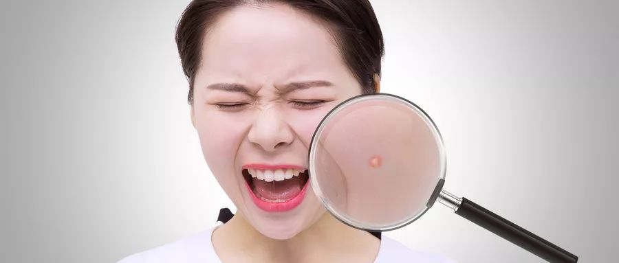 痘痘怎么治最快最有效的方法,痘痘怎么治疗最快有效