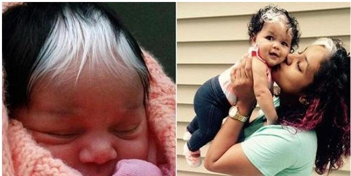 小孩子白头发父母如何正确引导,14岁小孩有白头发怎么办