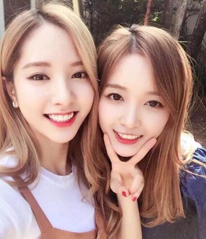 人中长颧骨高适合什么发型,人中长太阳穴凹陷