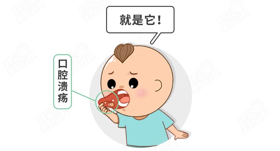 复发性口腔溃疡为什么会是绝症,冷知识口腔溃疡是一种绝症吗