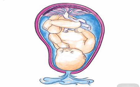 在台风利奇马的淫威下,宝妈破水了,破水跟天气有关?