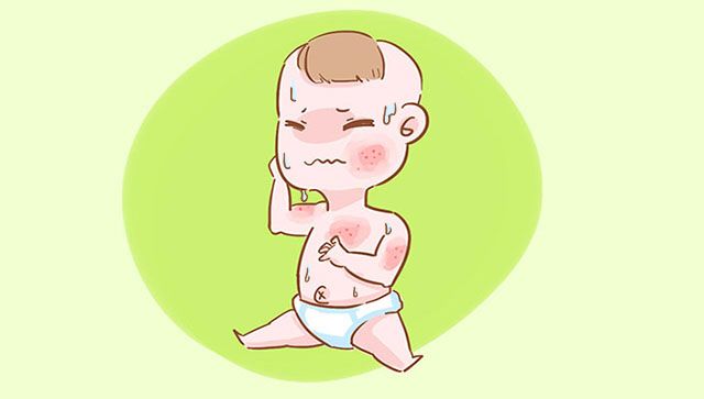 宝宝老是湿疹究竟是不是过敏体质,宝宝湿疹老是反复妈妈要忌口吗