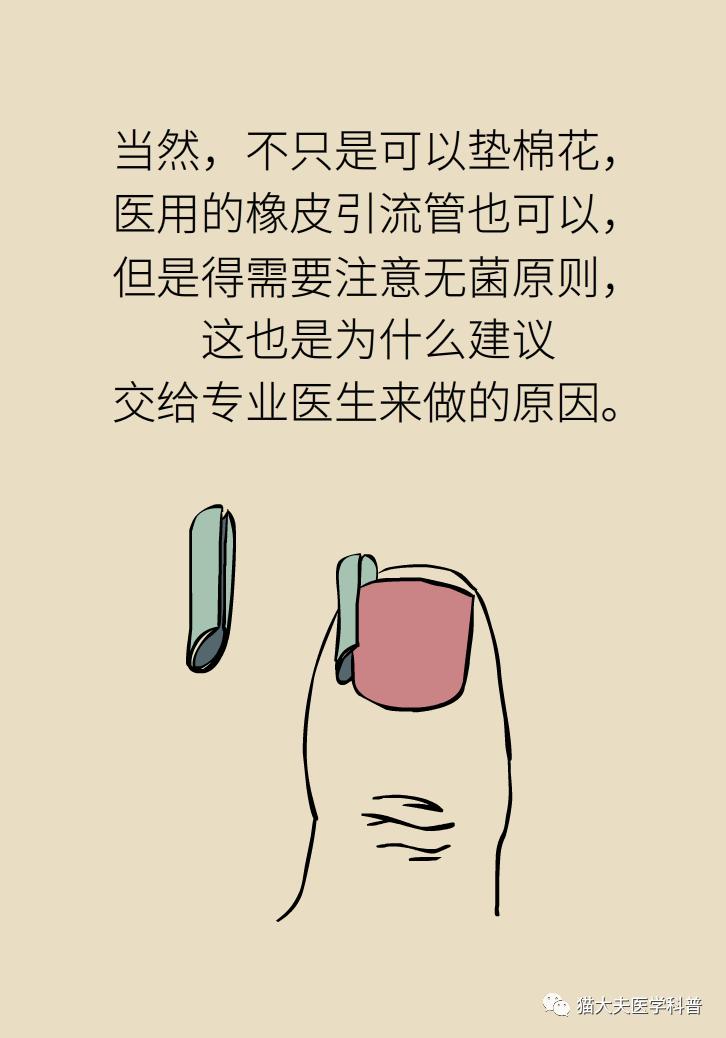 脚趾甲往肉里长怎么治除根,脚趾甲长在肉里面治疗视频