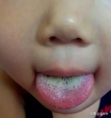 孩子吃撑了肚子疼痛厉害快速解决,为什么小孩子一吃饭肚子就痛
