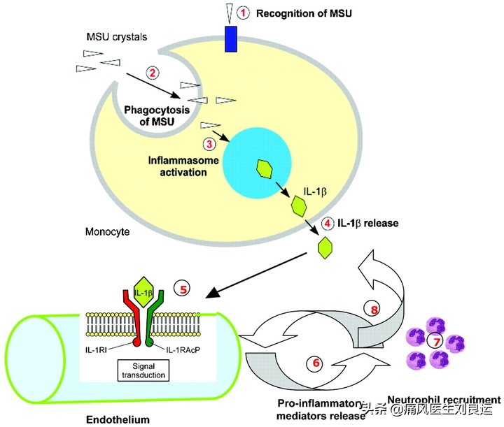 秋水仙碱能立刻止住痛风吗,秋水仙碱能消痛风石吗