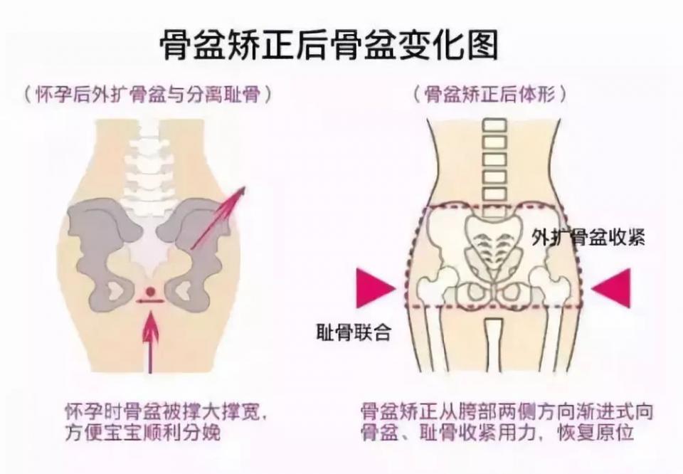 瑜伽教学课程，产后修复瑜伽课，宝妈们快收藏起来吧！