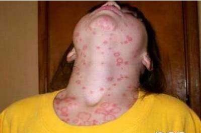 印度艾滋女投湖自杀，尸体被鱼啃食，吃鱼或水源会传染给我们吗？