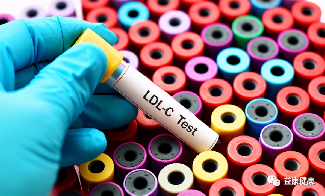 血脂高怎么办,血脂高怎么办吃什么能降脂肪