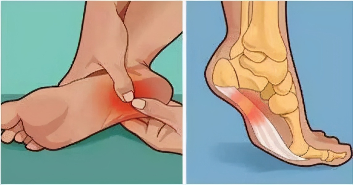 如何证明自己没有脚气？区区“脚气”，需要吃药治疗吗？