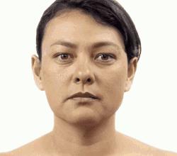 更年期应该顺其自然还是积极治疗,更年期不知道能撑到多久