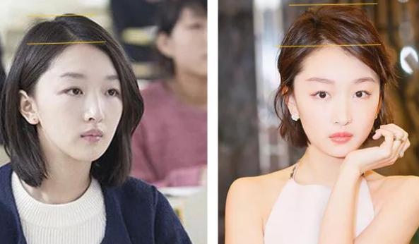 螨虫、出油、头皮干燥,到底是什么让你秃然成熟?