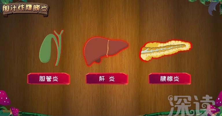 年轻人为什么会有急性胆囊炎,胆囊炎癌变扩散有什么特色药