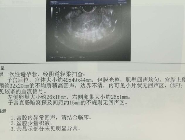 我都绝经12年了，怎么又出现流血了呢？这是咋回事？