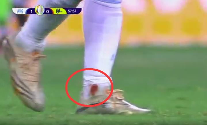 马丁内斯点球三连扑梅西队员反应,马丁内斯扑出点球阿根廷队员反应