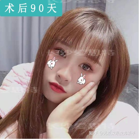 割双眼皮几毫米最好看,割双眼皮真的会好看吗