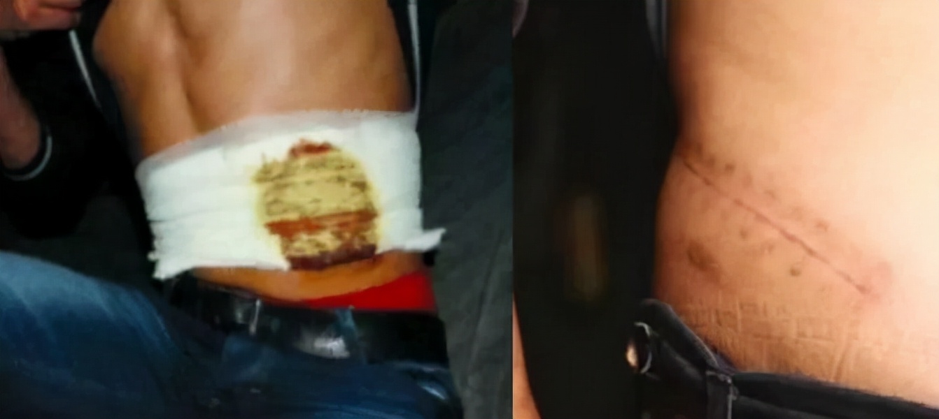 安徽17岁高中生，2万卖肾买苹果手机获巨额赔款，现在过得怎么样