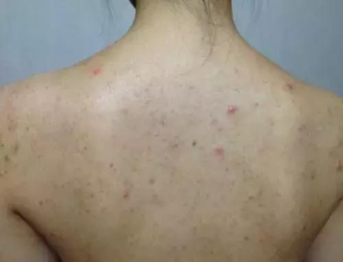 夏天就要心机露肤才更显瘦,又到了夏天露腿露肩的季节