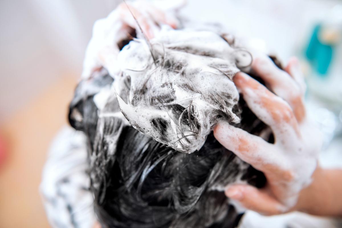 天天洗头还有头皮屑用什么洗发水,冬天天天洗头还是有好多头皮屑