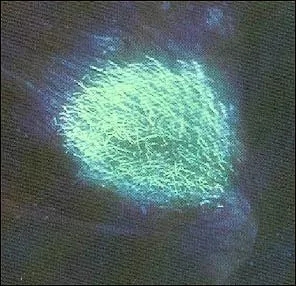 流浪猫猫癣是什么样的,金渐层猫得猫癣什么样