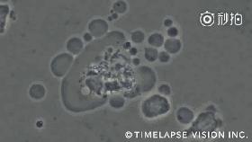 nk细胞疗法可以用于健康人群吗,肿瘤nk细胞疗法