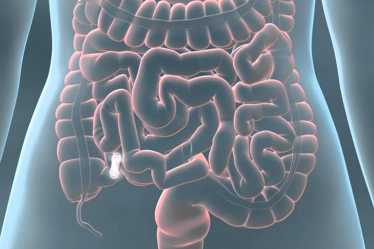 泻药酚酞,酚酞便秘药