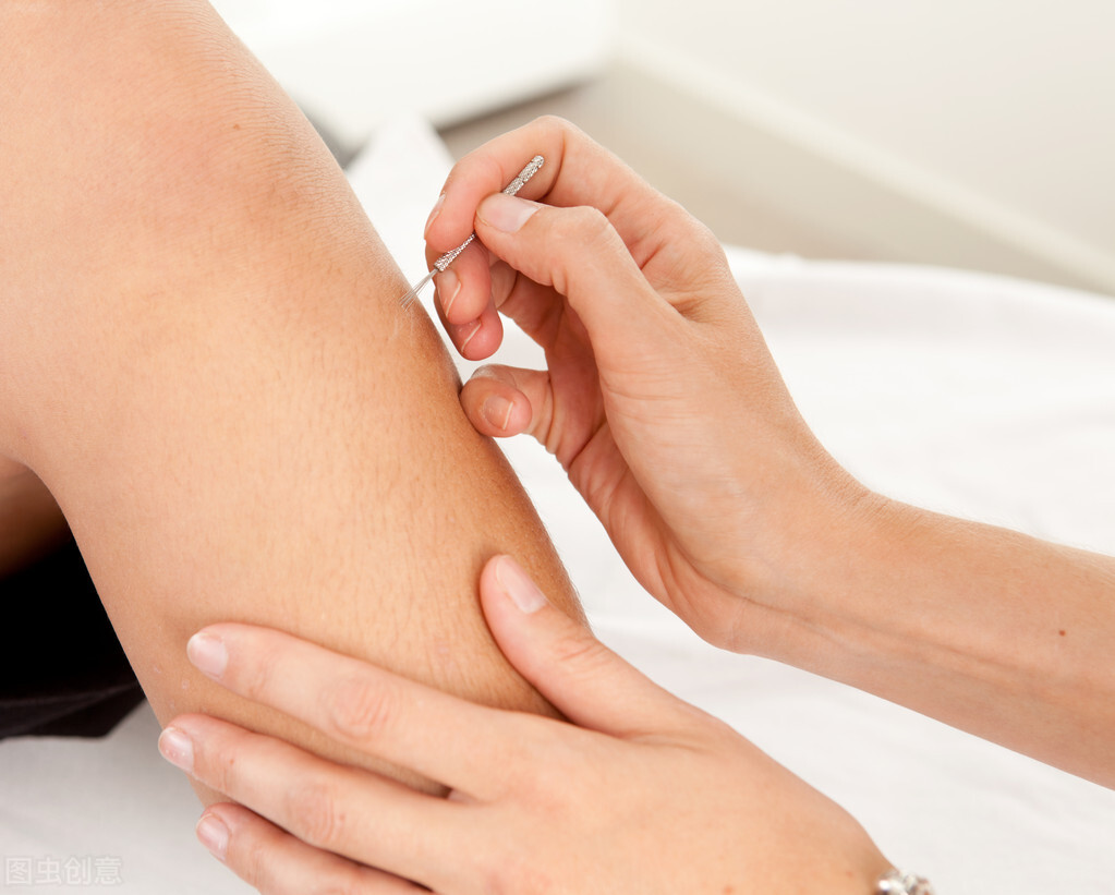 中风后遗症怎么治疗?试试针灸来调理,保守治理副作用小