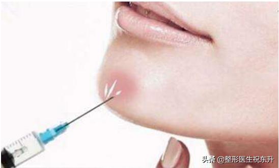 关于玻尿酸丰下巴的那些事...