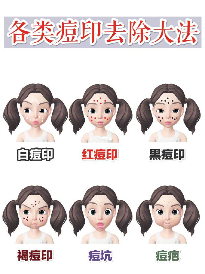去除黑头痘印痘坑痘疤的最好产品,痘坑痘印暗红色修复的最佳方法