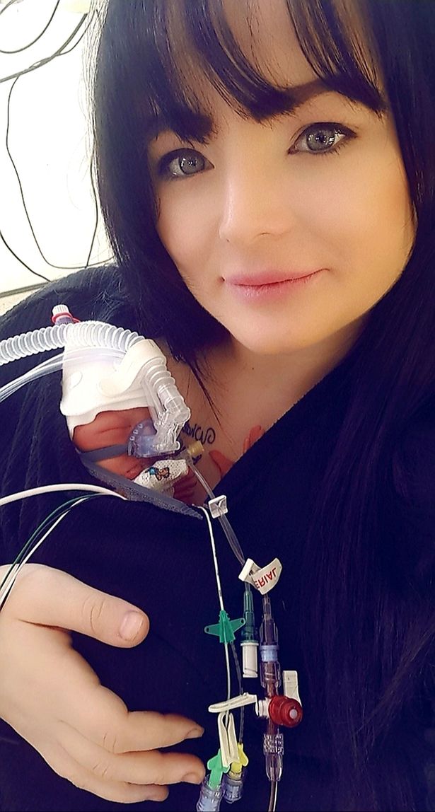 英国孕妇怀孕三胞胎,美国妈妈怀孕羊水破了