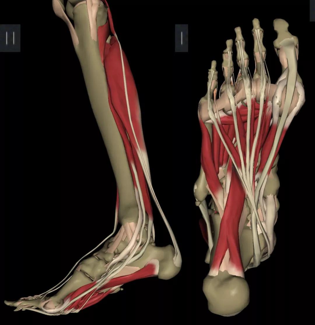 天生的平足需不需要治疗,平足治得了吗