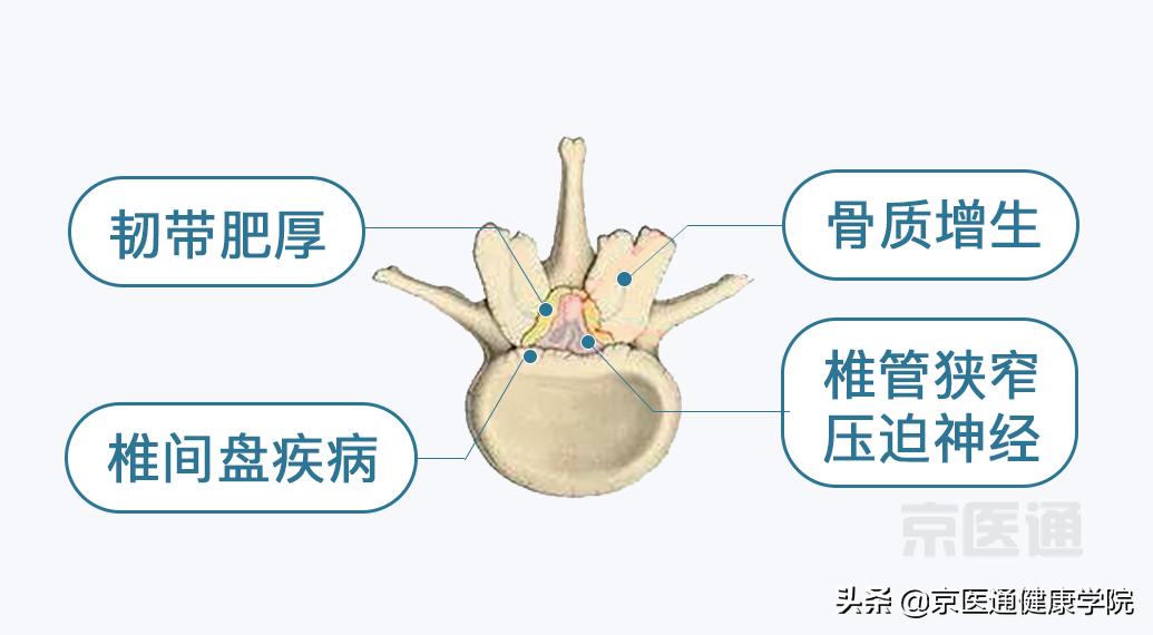 腰痛骨科怎么治疗,腰痛腿痛有什么特效药