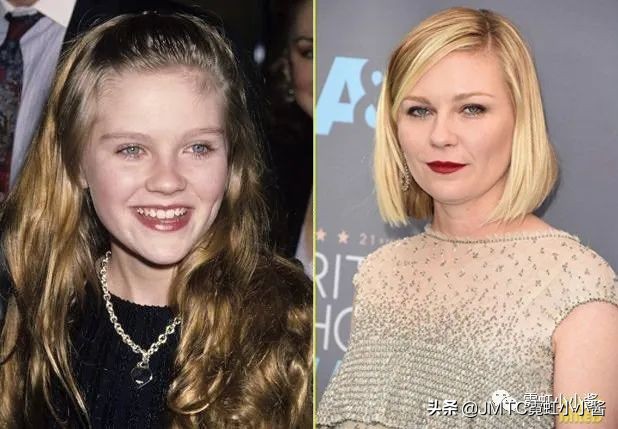 25岁抗老拯救垮脸,哪种脸型抗衰抗皱