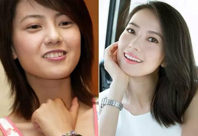 牙齿科普整牙堪比整形,整牙堪比换脸真的假的