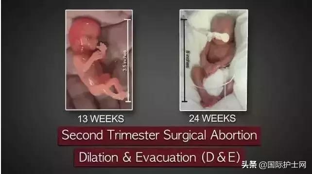 打胎有多可怕案例,20岁女生堕胎7次