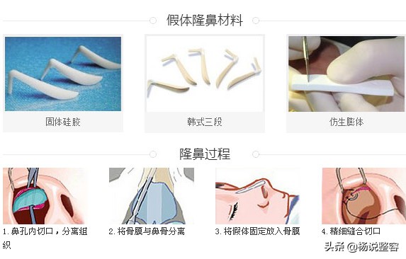 隆鼻失败修复的几点建议,隆鼻失败医生会马上为患者修复吗