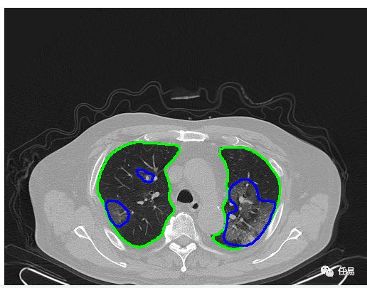 我国三年抗疫成就,抗击疫情最新技术