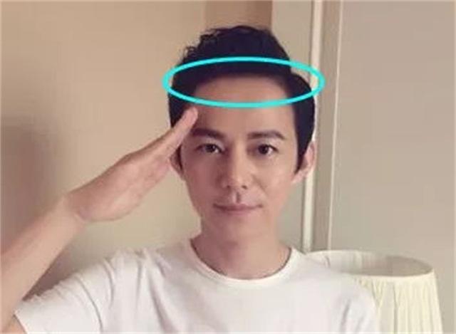 发际线补救视频,发际线后移的原因和补救方法