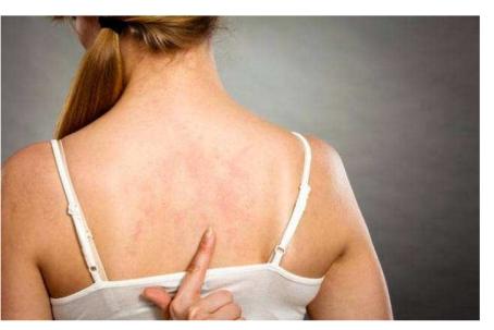 后背螨虫痘根治方法,一招去除背部螨虫痘