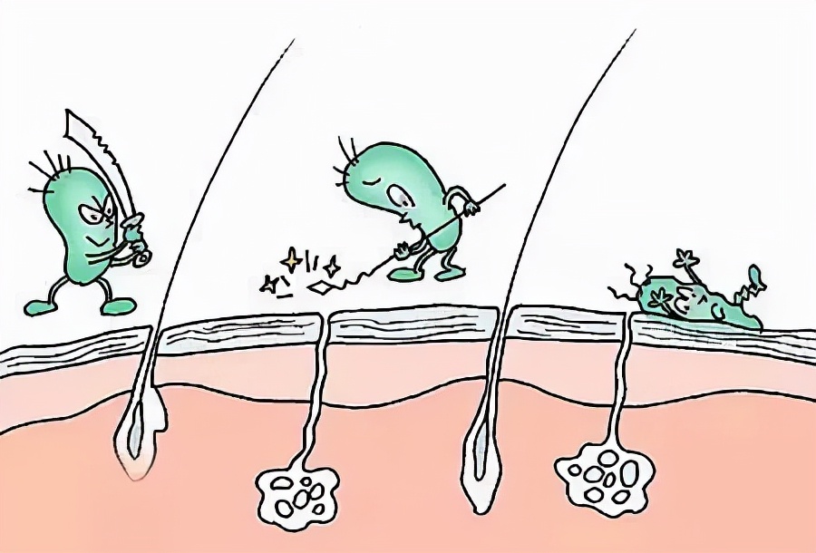 手足癣总是反复怎么治才能除根,手足癣是什么原因引起的怎么解决