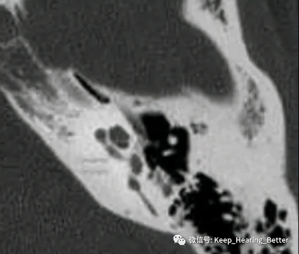 南大二附院,南大二附院耳鼻喉科专家